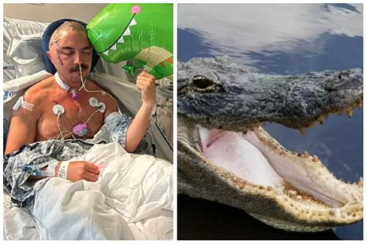 
A Florida man, Juan Carlos La Verde, 34, survives a 12-foot alligator attack despite losing half his skull 