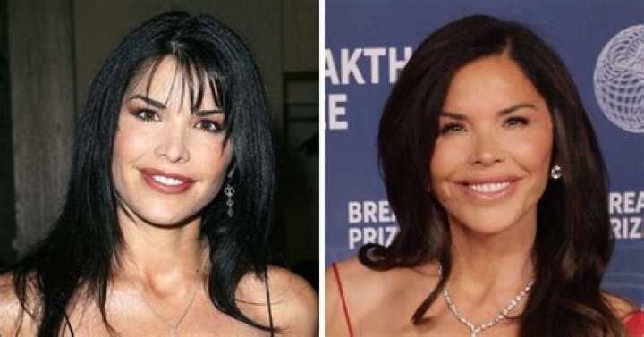 Alanna Panday Plastic Surgery: Before And After Photos