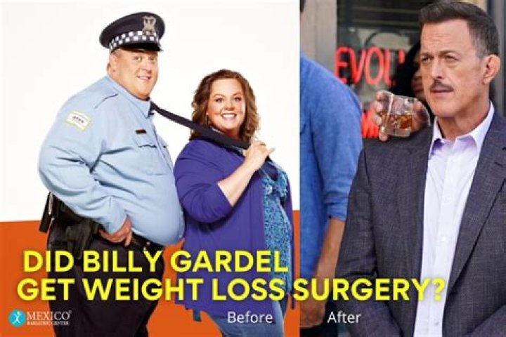 Billy Gardell Illness And Health Update: Did He Have Weight Loss Surgery, How Much Weight Did He Lose?