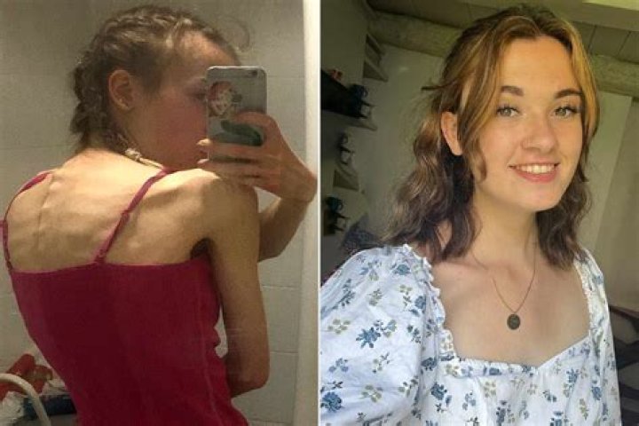 
Chloe Lattanzi’s Health Has Fans Worried After Anorexia – What’s Happened To Her? 