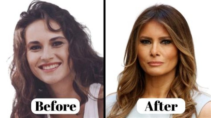 Did Lai Austria Get Plastic Surgery? Before & After Pictures Of The Model