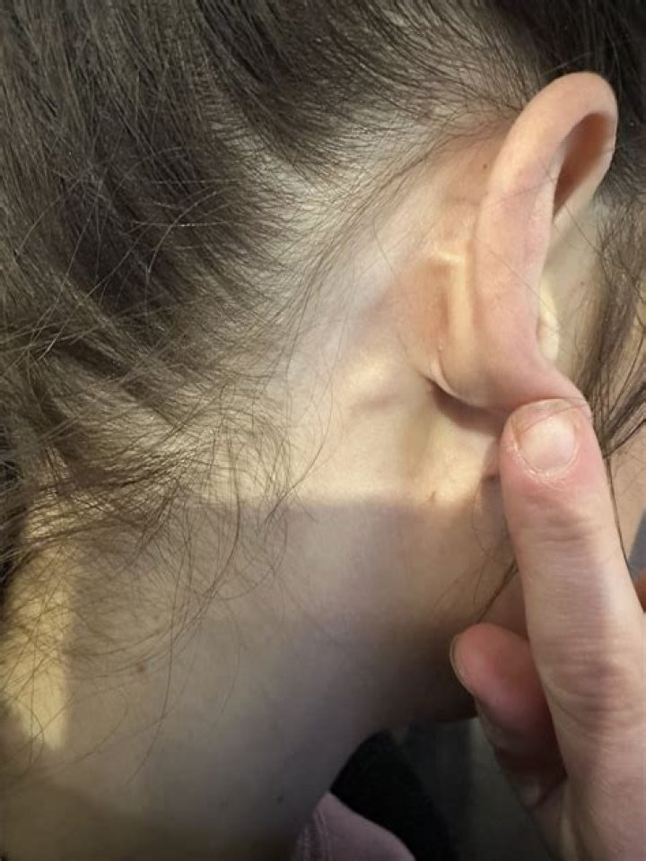 Fans Are Concerned After They Notice A Lump On Sherry Yard’s Neck