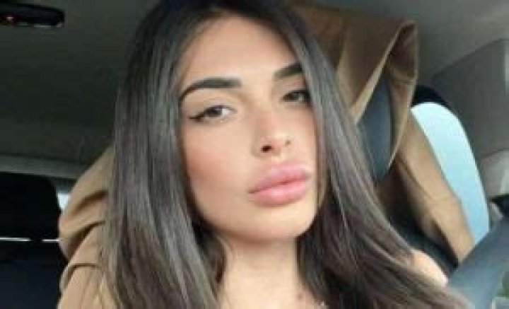 
Greta Rossetti Prima (Before) Surgery | Temptation Island Before And After Looks 