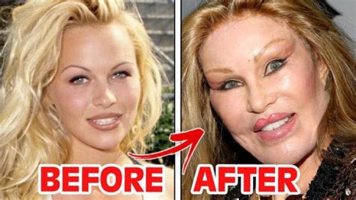 Has Kathie Lee Gifford Had Plastic Surgery? Before And After Photos On IG