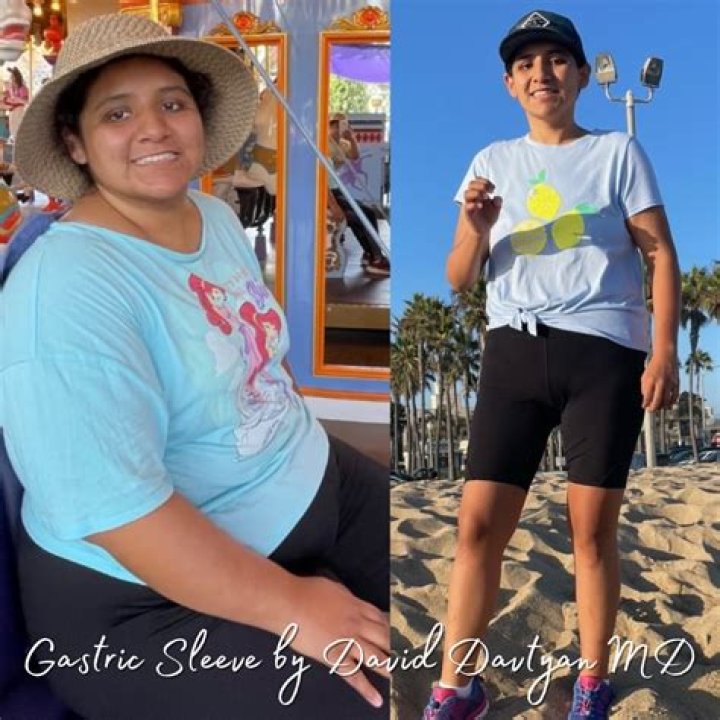 Muni Long Weight Loss Journey, Plastic Surgery – Before And After Photos