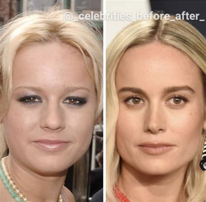 TS Madison Plastic Surgery – Before And After Photos Explored