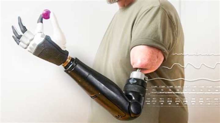 Who Is Allison Vest From Body Parts? Know About Prosthetics Rehabilitation From TLC Show